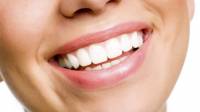 Teeth Whitening Surrey