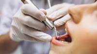 Dental Fillings Surrey