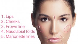 Dermal FIllers