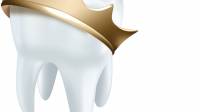 Dental Crowns