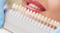 Teeth Whitening Cardiff