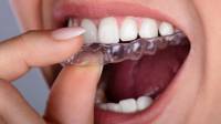 Invisalign Cardiff